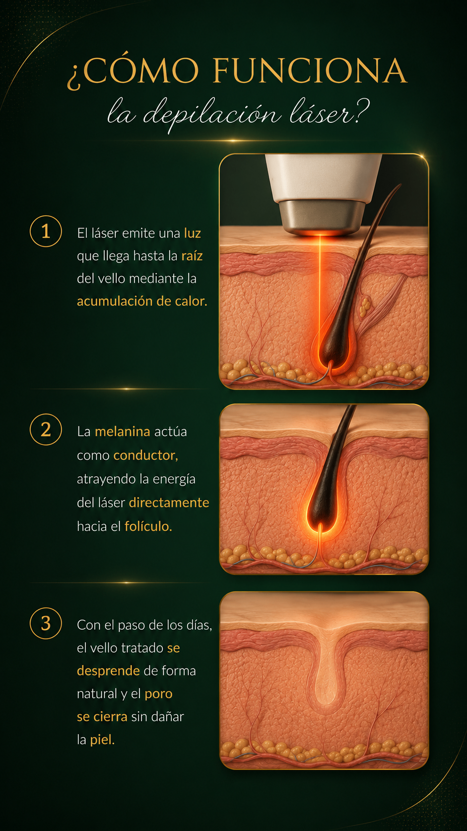 Cómo funciona la depilación láser